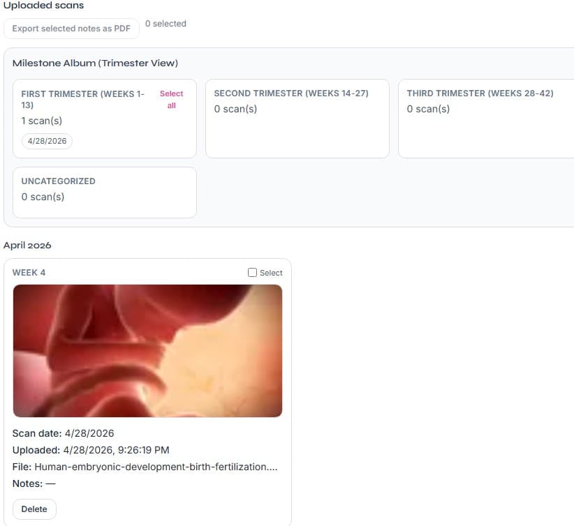 Real LumaTracer ultrasound timeline view showing upload flow and trimester album